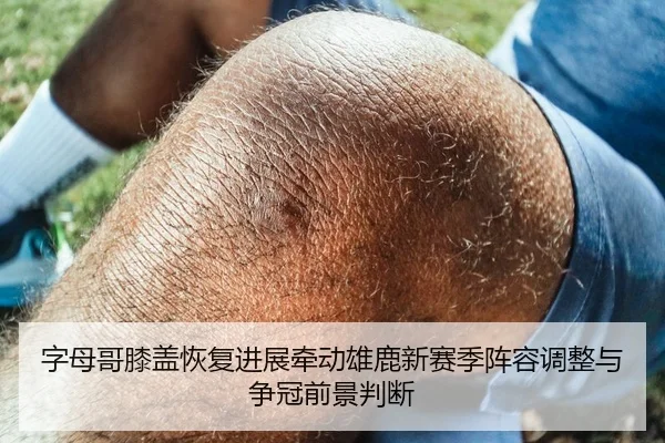 字母哥膝盖恢复进展牵动雄鹿新赛季阵容调整与争冠前景判断